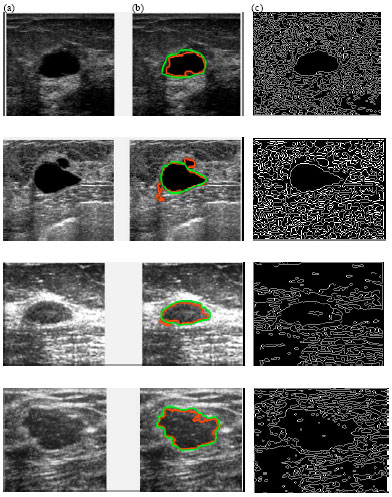 Image for - Automatic Tissue Segmentation in Medical Images using Differential Evolution