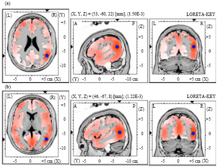 Image for - Cortical Activation of Level-to-Contour Tone Changes in Different Vowel Duration Indexed by Mismatch Negativity