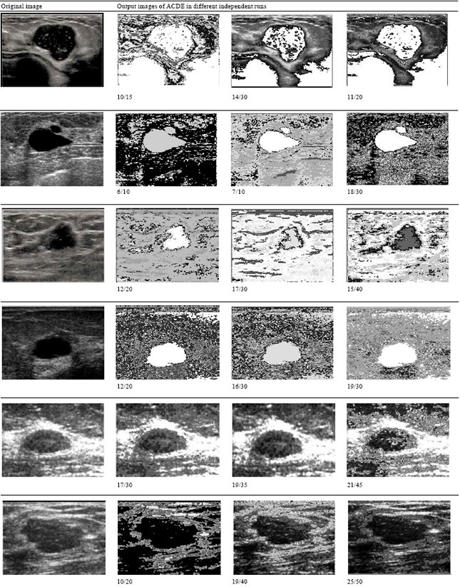 Image for - Automatic Tissue Segmentation in Medical Images using Differential Evolution
