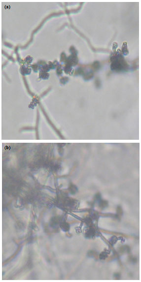 Image for - Efficiency of Actinomycetes Against Phytopathogenic Fungus of Chilli Anthracnose