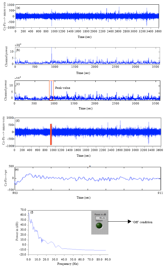 Image for - Detection of Epileptic Seizure in EEG Recordings by Spectral Method and Statistical Analysis
