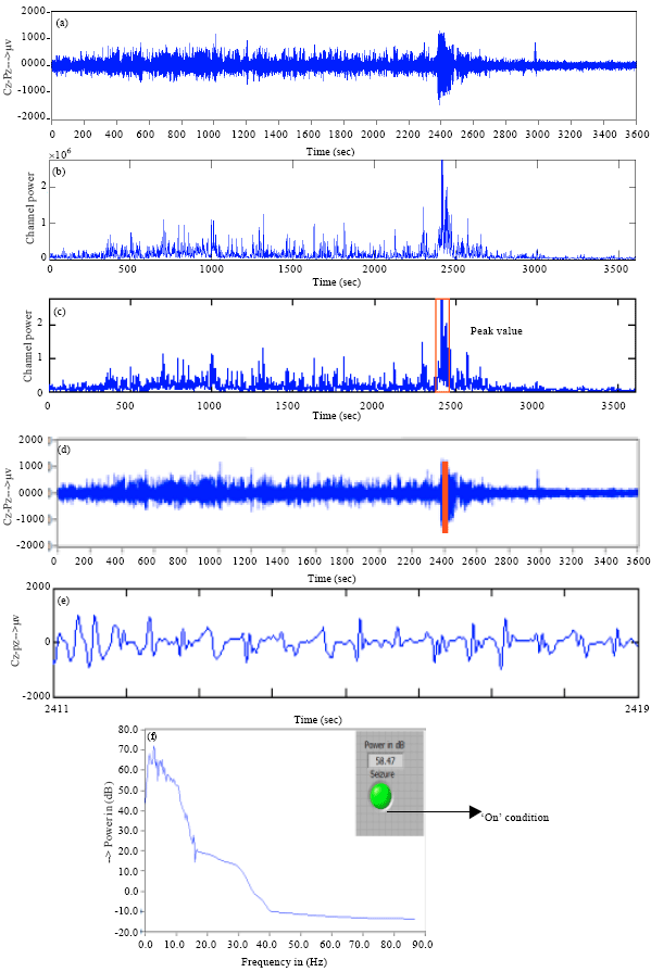 Image for - Detection of Epileptic Seizure in EEG Recordings by Spectral Method and Statistical Analysis