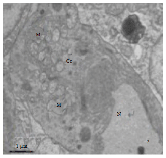 Image for - Microscopic Observation on Gill Structure of Juvenile Pseudosciaena crocea under Different Salinities