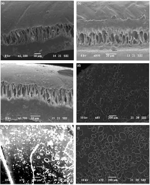 Image for - Effect of Polyethylene Glycol Membrane on the Separation of Biodiesel from Palm Oil