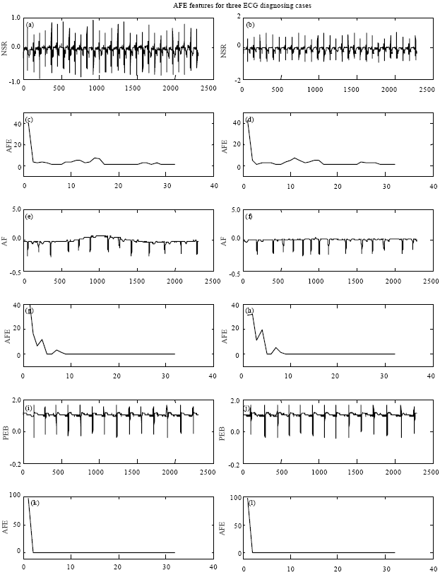 Image for - Application of ECG Arrhythmia Classification by Means of Bayesian Theorem