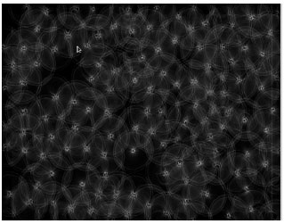 Image for - Red Blood Cells Counting by Circular Hough Transform Using Multispectral Images
