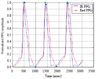 Image for - Biological Assessments by Innovative Use of Multi-Wavelength Photoplethysmographic Signals Time Differences