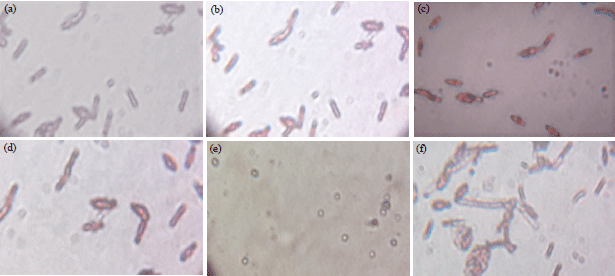 Image for - Isolation and Characterization of Pathogenic Bacteria from Kundu River Water of Nandyal, Kurnool, Andhra Pradesh, India