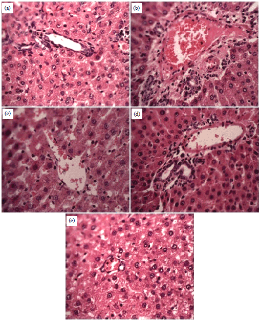 Image for - Pharmacological Evaluation of Chrozophora tinctoria as Hepatoprotective Potential in CCl4 Induced Liver Damage in Rat