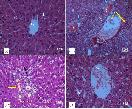 Image for - Ameliorative Effect of Lipoic Acid on Cadmium Induced Hepatotoxicity and Nephrotoxicity in Rats