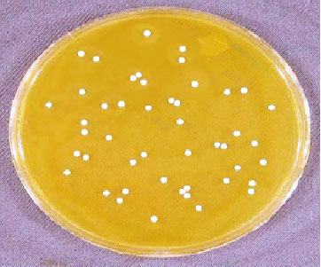 Image for - Confirmation of the Identity of Lactobacillus Species using Carbohydrate Fermentation Test (API 50 CHL) Identification System