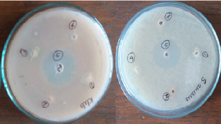 Image for - Identification of Antibacterial Compound from Bacillus horikoshii, Isolated from Rhizosphere Region of Alfalfa Plant