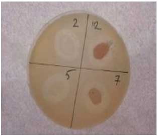 Image for - Studies on Hyaluronidase Extracted from Staphylococcus aureus Isolated in Khartoum/Sudan