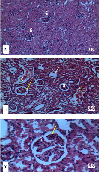 Image for - Ameliorative Effect of Lipoic Acid on Cadmium Induced Hepatotoxicity and Nephrotoxicity in Rats