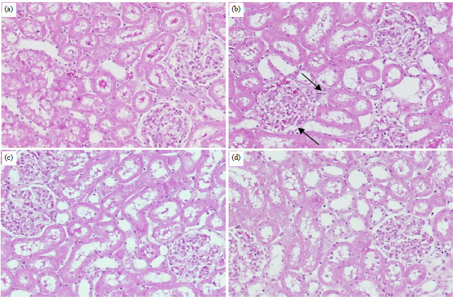 Image for - Protective Effect of Morin, A Flavonoid Against Hypercholesterolemia-induced Hepatic and Renal Toxicities in Rats