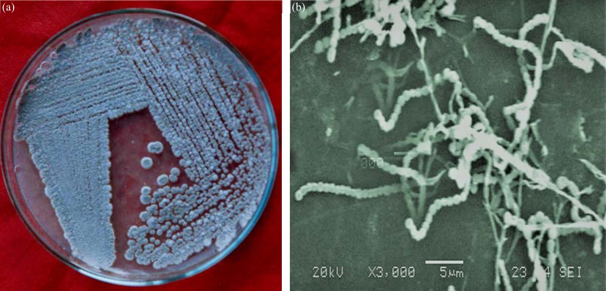 Image for - Antimicrobial Efficiency of a Marine Streptomyces sp. VPTSA1-4 Isolated from Coromandel Coast of Bay of Bengal, India