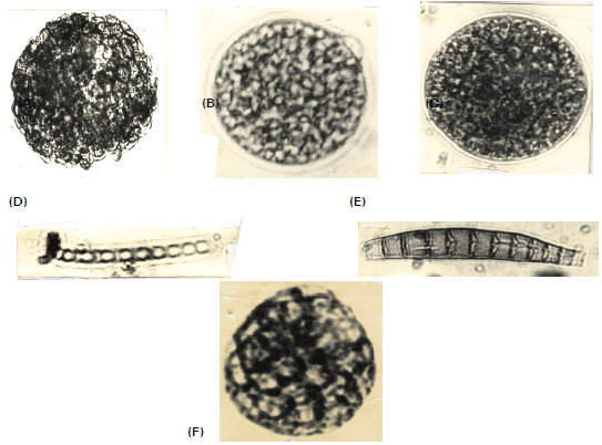 Image for - Rare Fossil Algal, Fungal and Riccia Spores Isolated from Sonda Coal Deposits, District, Thatta, Sindh, Pakistan