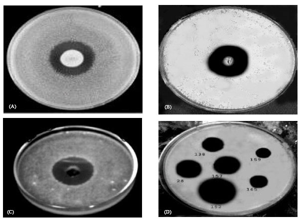 Image for - Screening of Antagonistic Activity in Different Streptomyces Species Against Some Pathogenic Microorganisms