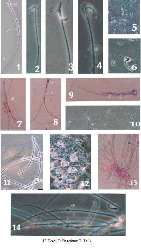 Image for - Studies on Spermatotoxic Effect of Ethanolic Extract of Capparis aphylla (Roth)