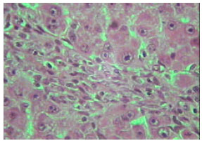 Image for - Inhibitory Effect of Melatonin on Histological Changes Induced in Rat Liver by Thioacetamide Intoxication