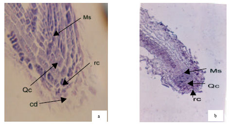 Image for - Root Apical Meristem Characteristics of Two Canola (Brassica napus L.) In Response to Salt Stress