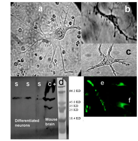 Image for - Characterization and Transdifferentiation of Human Mesothelial Progenitor/Stem Cells of the Peritoneum Cavity