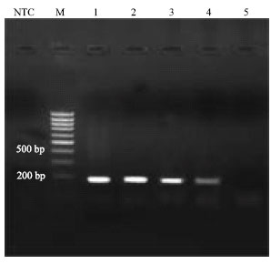 Image for - Evaluation of a New, Highly Sensitive and Specific Primer Set for Reverse-transcriptase PCR Detection of HIV-1 Infected Patients: Comparison with Standard Primers