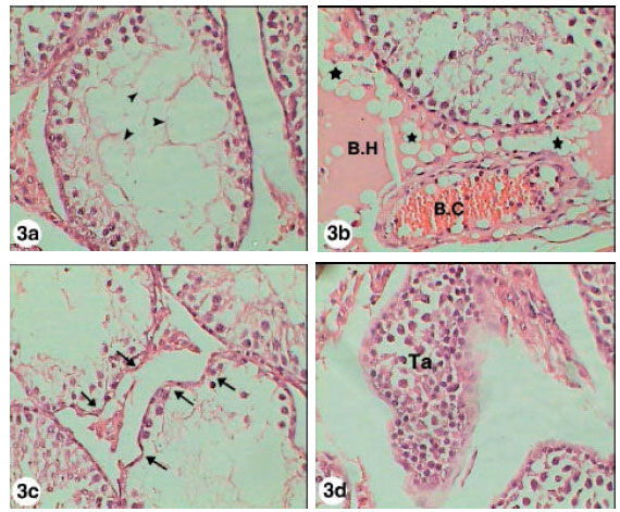 Image for - Testicular Histopathological Alterations in Rats Treated with Sumithion® NP 25/2.5 EC, Insecticide