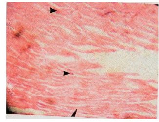 Image for - Methanolic Extract of Entandrophragma angolense Induces Gastric Mucus Cell Counts and Gastric Mucus Secretion