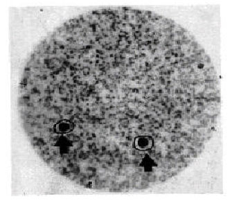 Image for - Nuclear Proteins Associated with Hyphen Growth in Candida albicans