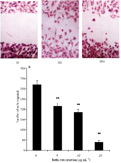 Image for - Antiangiogenic Effect of Rutin and its Regulatory Effect on the Production of VEGF, IL-1β and TNF-α in Tumor Associated Macrophages