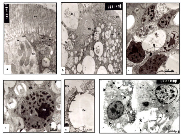Image for - Histological and Ultrastructural Changes Induced by Two Carbamate Molluscicides on the Digestive Gland of Eobania vermiculata
