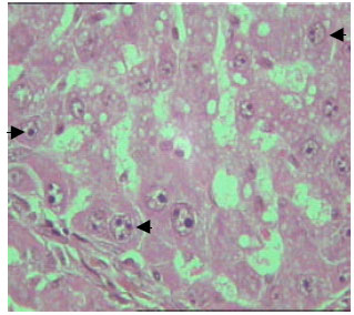 Image for - Inhibitory Effect of Melatonin on Histological Changes Induced in Rat Liver by Thioacetamide Intoxication