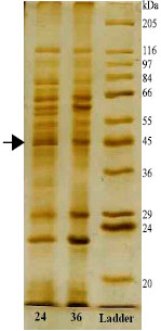Image for - Metronidazole Resistance of Helicobacter pylori Clinical Isolates in a Hospital in Iran and Protein Pattern of Two Strains Showing Differences in Susceptibility