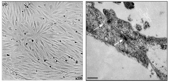 Image for - Bioelectrical and Permeability Properties of Brain Microvasculature Endothelial Cells: Effects of Tight Junction Modulators