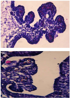 Image for - Microanatomical Study of the Maternal Diabetes Effects on Rat`s Choroids Plexus in Embryonic, Neonatal and Adulthood Stages