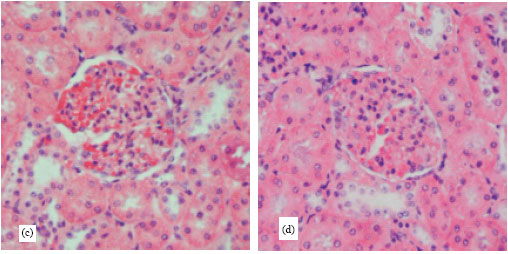 Image for - Effects of Garlic (Allium sativum) on Blood Sugar and Nephropathy in Diabetic Rats