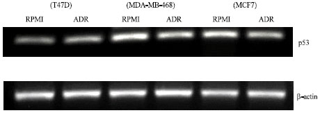Image for - p53 Expression in MCF7, T47D and MDA-MB 468 Breast Cancer Cell Lines Treated with Adriamycin Using RT-PCR and Immunocytochemistry