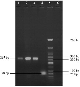 Image for - High Resolution Allotyping of Four Alleles of HLA-DRB1*01 Group in Iranians Using Reverse-SSOPH Assay in Comparison with DNA Sequencing and PCR-SSP