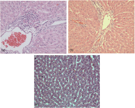 Image for - The Effect of Pretreatment of Zerumbone on Fatty Liver Following Ethanol Induced Hepatotoxicity