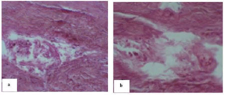 Image for - Experimental Study of the Tendon Healing and Remodeling After Local Injection of Bone Marrow Myeloid Tissue in Rabbit