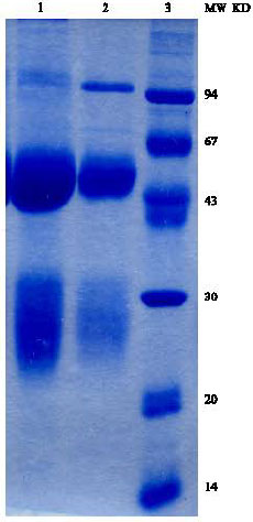 Image for - Production and Purification of Polyclonal Antibody Against Human Kappa Light Chain