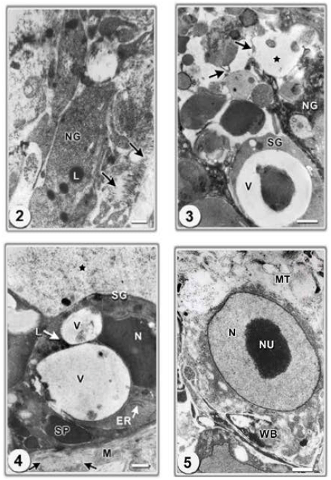 Image for - Ultrastructural Alterations in Testis and Gastrodermis of Schistosoma mansoni Due to Treatment of Infected Mice with the New Rhodanine Derivative Ro-354