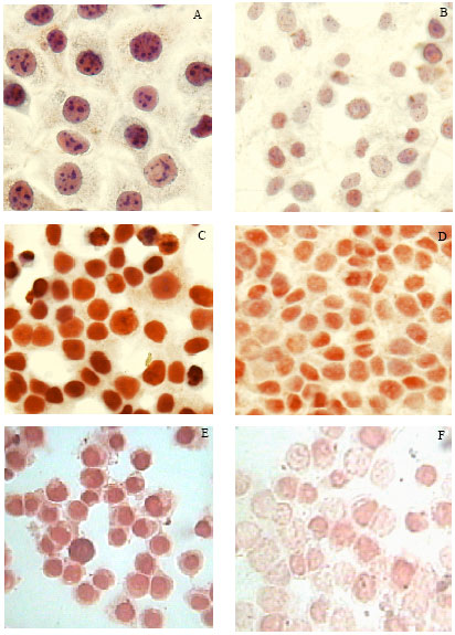 Image for - p53 Expression in MCF7, T47D and MDA-MB 468 Breast Cancer Cell Lines Treated with Adriamycin Using RT-PCR and Immunocytochemistry