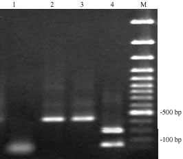 Image for - Molecular Identification of Giardia duodenalis Isolates from Human and Animal Reservoirs by PCR-RFLP
