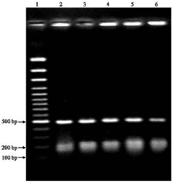Image for - Molecular Characterization of Cryptosporidium Isolates from Cattle in a Slaughterhouse in Tabriz, Northwestern Iran