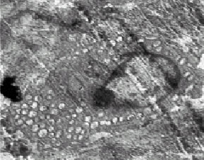 Image for - The Ultra Structural Study of Blastema in Pinna Tissues of Rabbits with Transmission Electron Microscope
