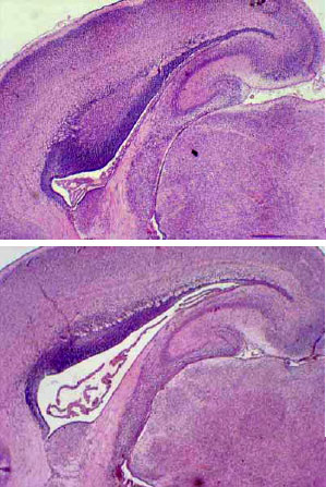Image for - Maternal Hyperglycemia Proliferate Choroids Plexus and Enlarge the Lateral Ventricle in Brain of Newborn Rats