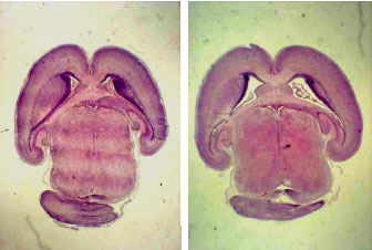 Image for - Brain Ventricular Enlargement in Embryonic, Neonatal and Adulthood Stages of Rats Born from Diabetic Mothers