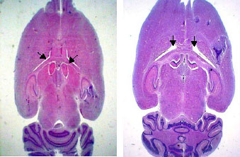 Image for - Brain Ventricular Enlargement in Embryonic, Neonatal and Adulthood Stages of Rats Born from Diabetic Mothers